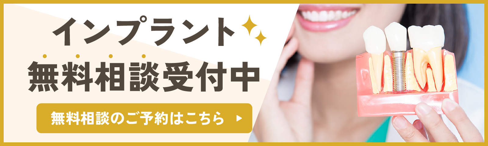 インプラント無料相談受付中